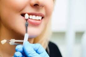 The Benefits of Quick Dental Consultation in Downtown Vancouver